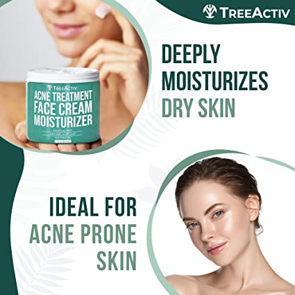 TreeActiv Acne Eliminating Face Cream