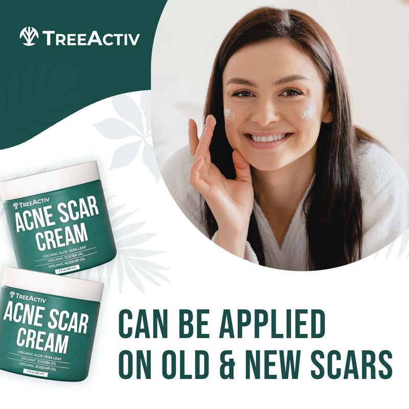 Acne Scar Cream