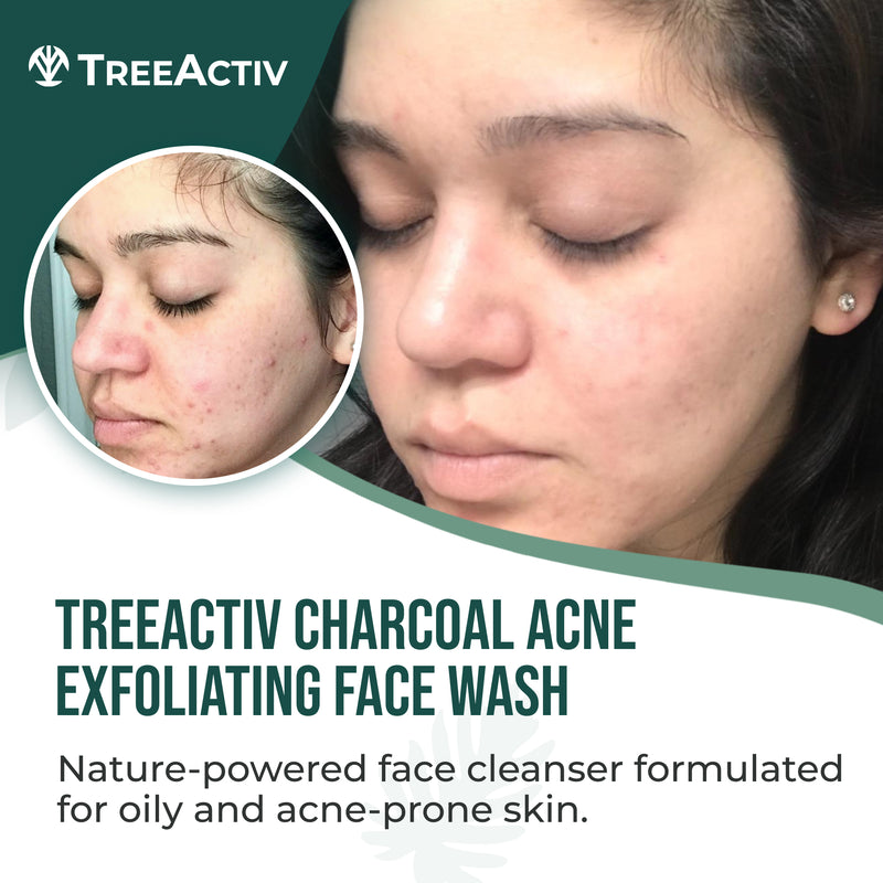 Acne Eliminating Face Cleanser